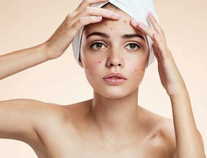 Skin Clear Serum - 30ml